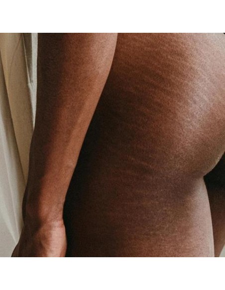 Aceite antiestrías. We are mammas